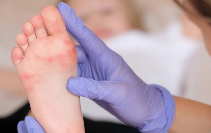 best chiropodist in Toronto